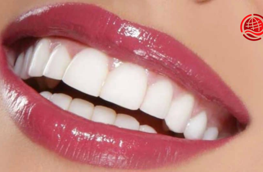 Specialist in Hollywood Smile Makeovers