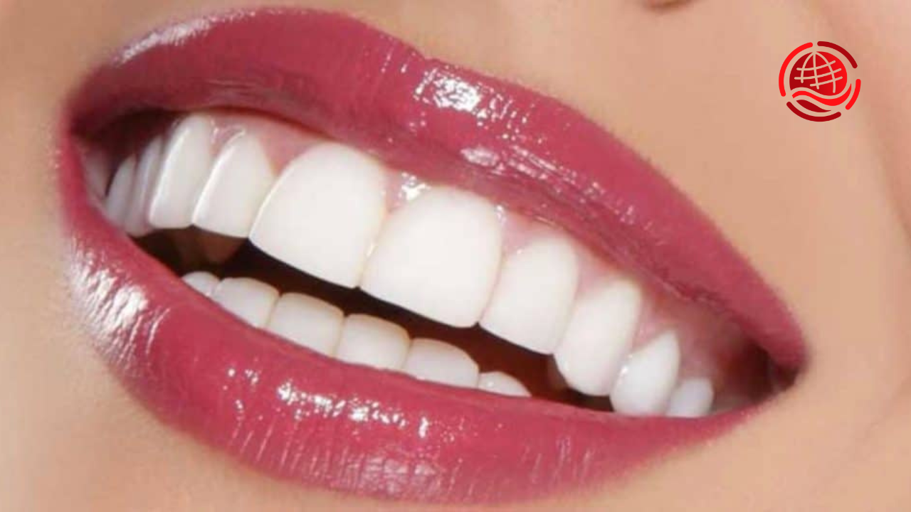 Specialist in Hollywood Smile Makeovers